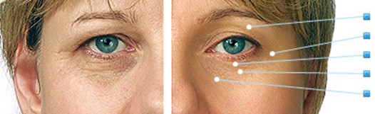 Reducing Wrinkles Through Exfoliating
